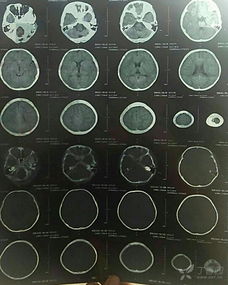 扩张系小说什么意思