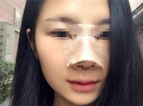 琼鼻,琼鼻朱唇什么意思