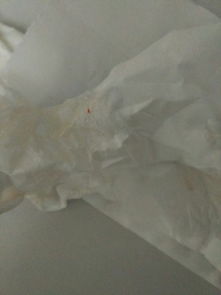 中国功夫里的‘血道’(点血)真的有吗?