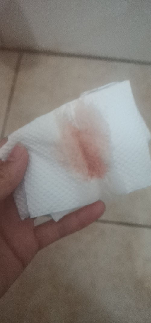 点血，点血是什么意思