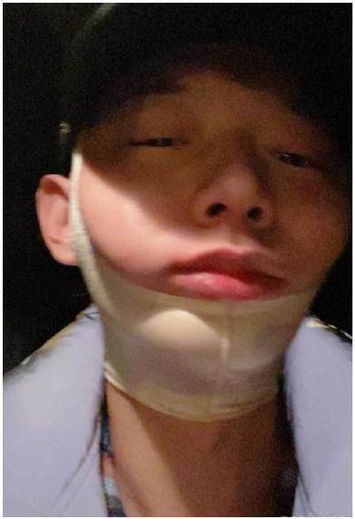 打哈欠真的会下巴脱臼嘛?