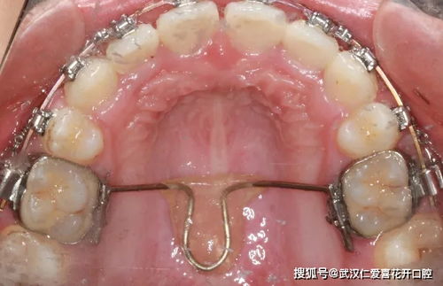 牙突零式现实中有这招么