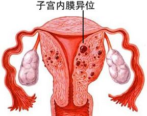 子宫在哪，子宫在哪个部位