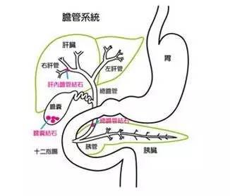 孕妇 胆囊在哪