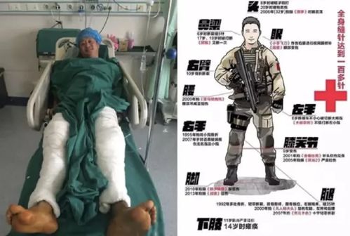 吴京全身缝针高达100多针，吴京全身缝针高达100多针news.