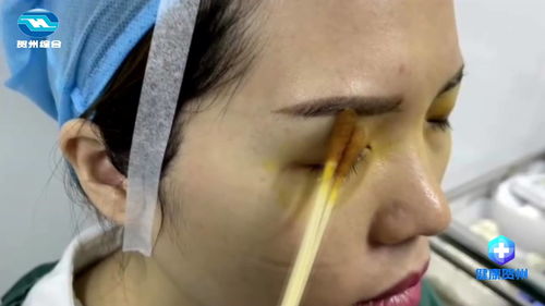 近视修正手术有后遗症吗，近视修正手术怎么做