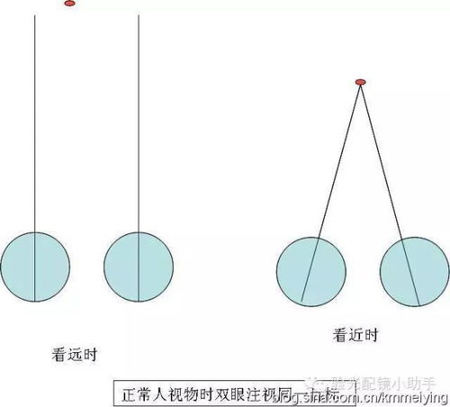 眼位异常是什么意思啊,眼位检查的方法及判断